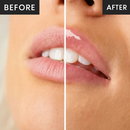 Aurelia Hydragloss™