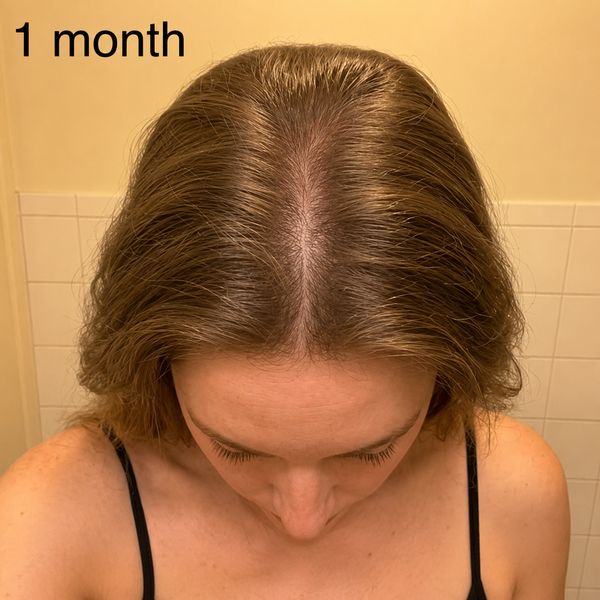 Hairafter 1 month of use