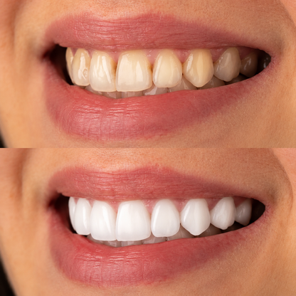HAPGuard Fresh™Tooth-Protecting Freshening Toothpaste