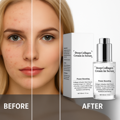 Skinova™Collagen Anti-Wrinkle Cream