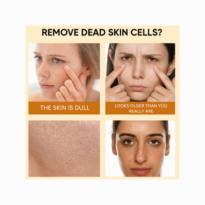 RadiantOrange™Dead Skin Removal