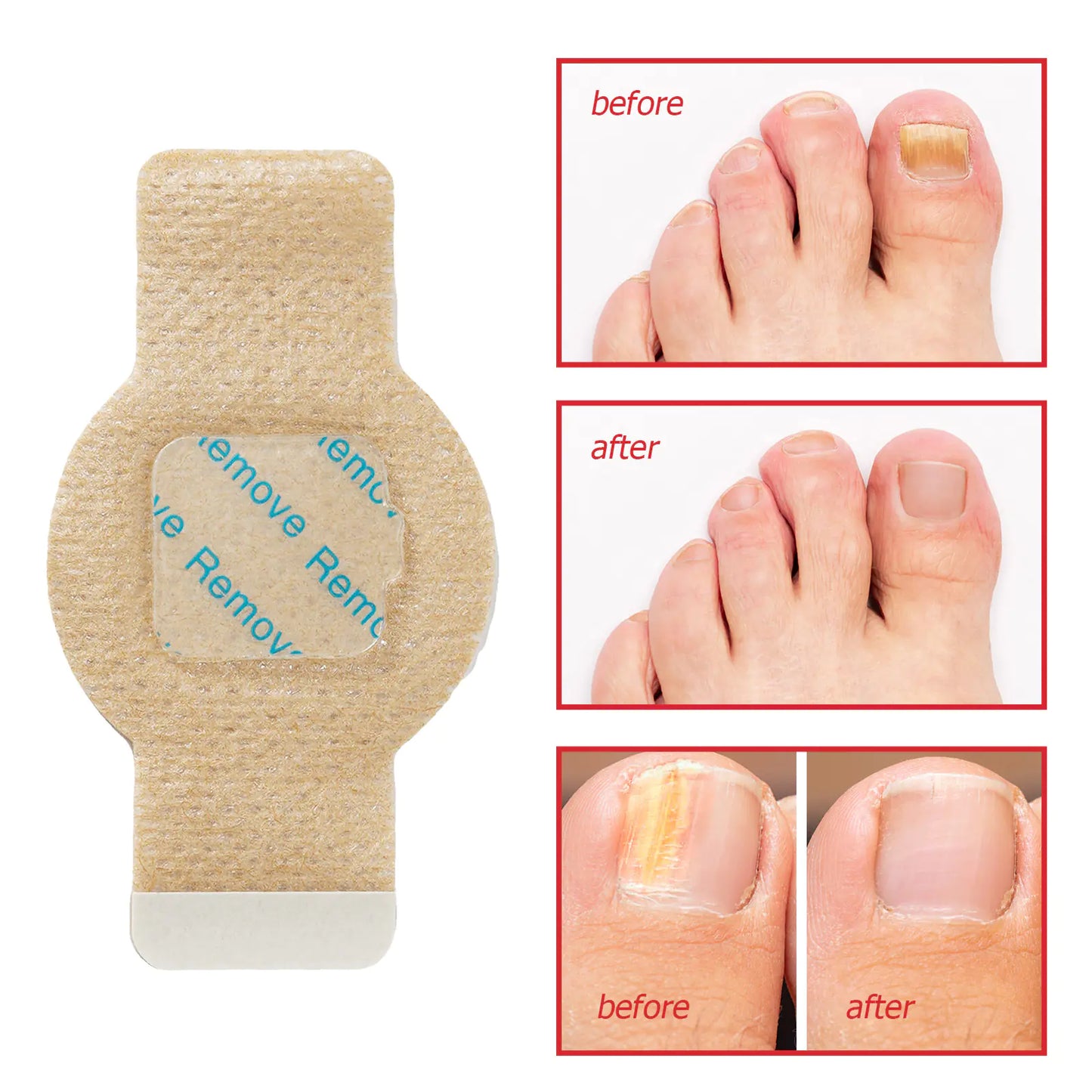 FungiCare Nail Repair Patches™
