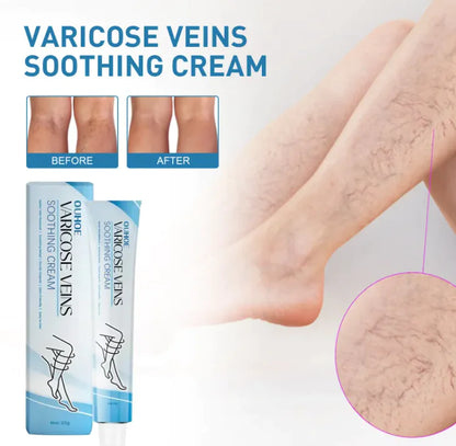 Varicose vain,Pain Relief Cream