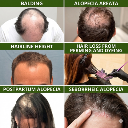 LuxeFollicle™Herbal Shampoo for Hair Thickness