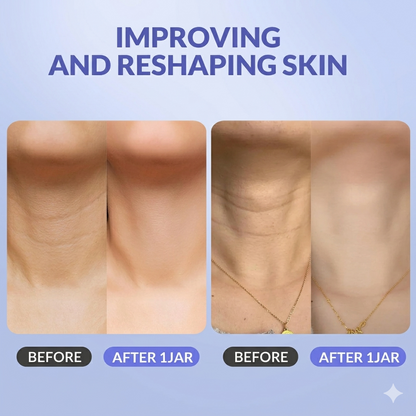 Velnara™Neck Cream – Lightens, Firms, and Smooths Fine Lines.