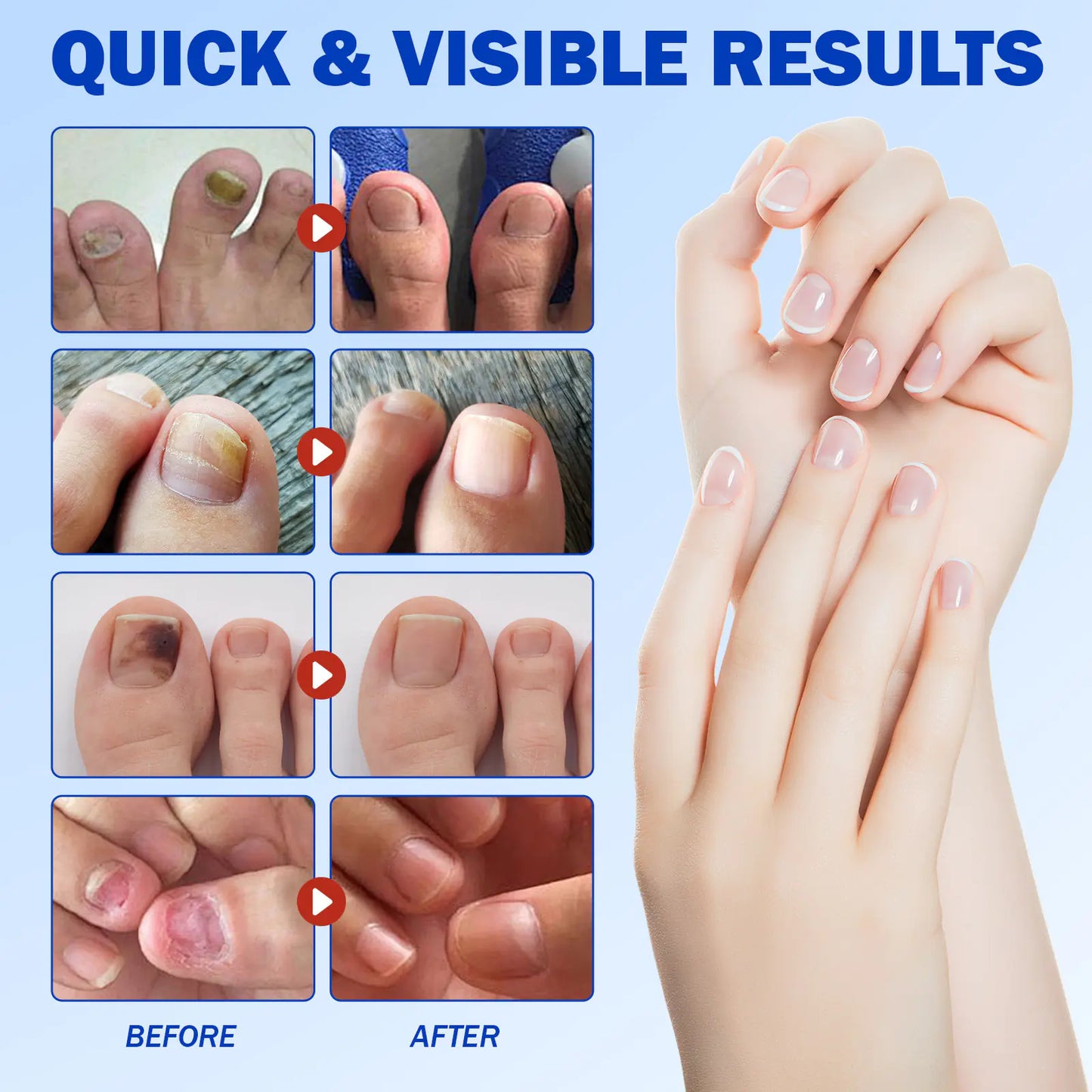 FungiCare Nail Repair Patches™