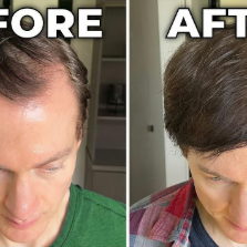 Herbaluxe Growth Oil™Hair Growth