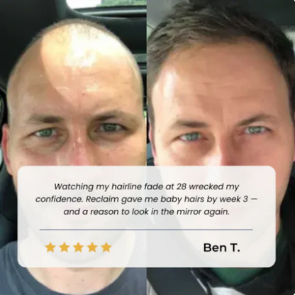 Herbaluxe Growth Oil™Hair Growth