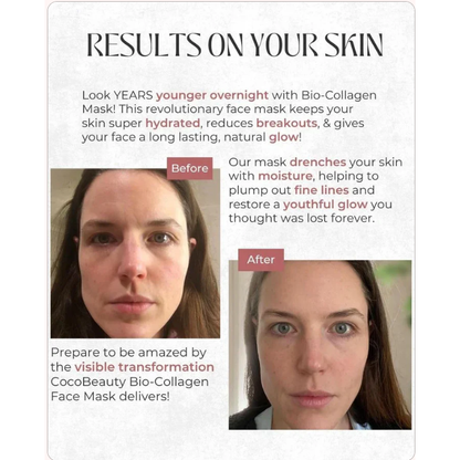 HydroGlow Collagen Mask™