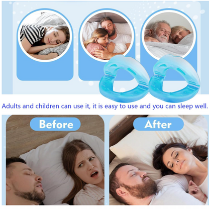 HushSleep™Anti-Snoring Mouthguard