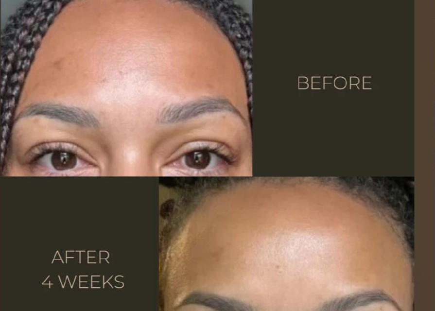 ReviveTonic™Kojic Acid Facial Cleanser