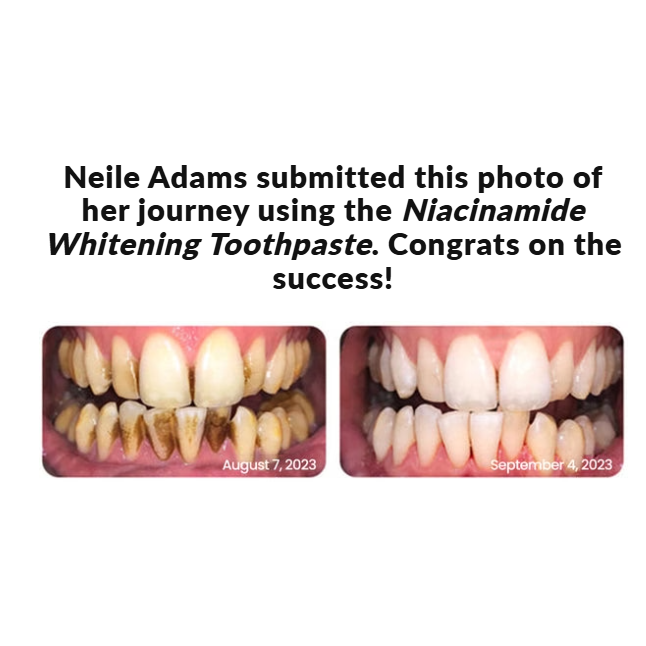 GlowDent™ nicotinamide Whitening Toothpaste